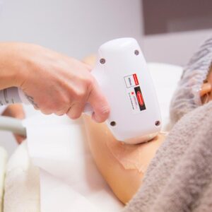 Coupon 10 buoni Epilazione Laser